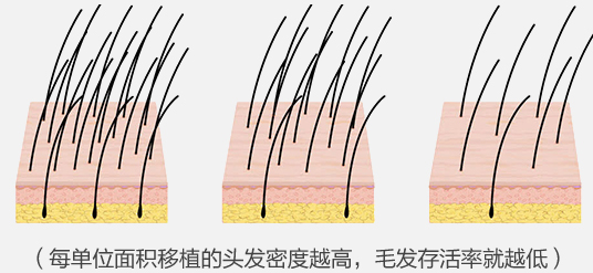 高密度移植