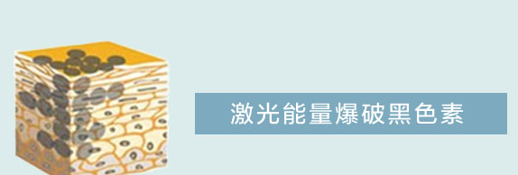祛雀斑5