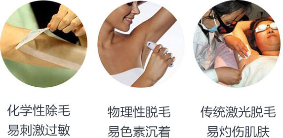 脱毛方法