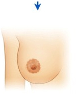 乳晕缩小非常终效果